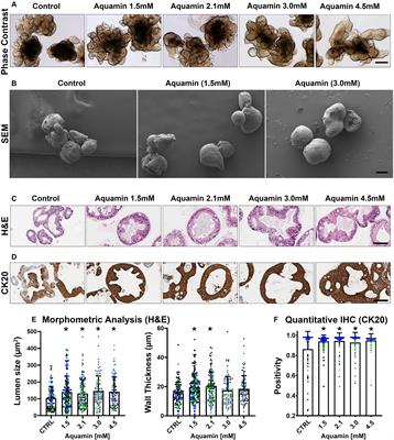 Ulcerative Colitis-Derived Colonoid Culture: A Multi-Mineral-Approach to Improve Barrier Protein Expression